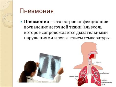 Взаимосвязь затруднения дыхания и передвижения при развитии пневмонии