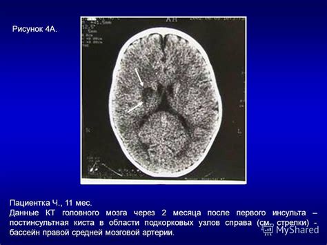 Влияние меланина на функционирование головного мозга