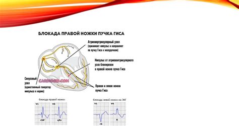 Влияние нарушений проводимости на сердечную работу