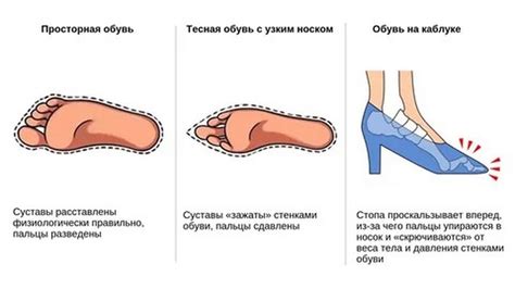 Влияние неправильной посадки на здоровье