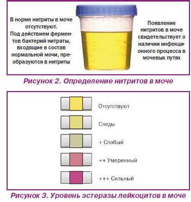 Влияние питания и напитков на окраску мочи