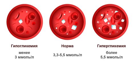 Влияние питания на уровень глюкозы в крови