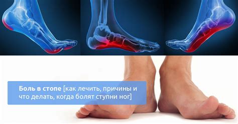 Воспалительные процессы как причина отека и боли в ноге