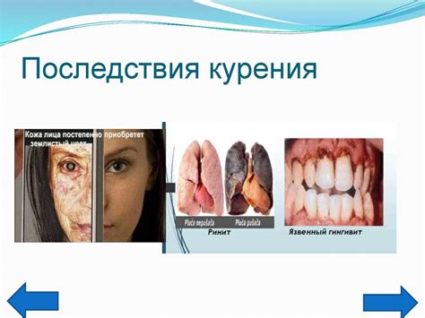 Вредные последствия отсутствия расчесывания