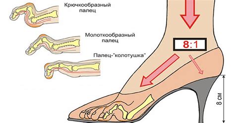 Выбор низкого и устойчивого каблука