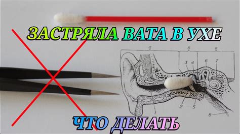 Вытащите обгоревшую вату.