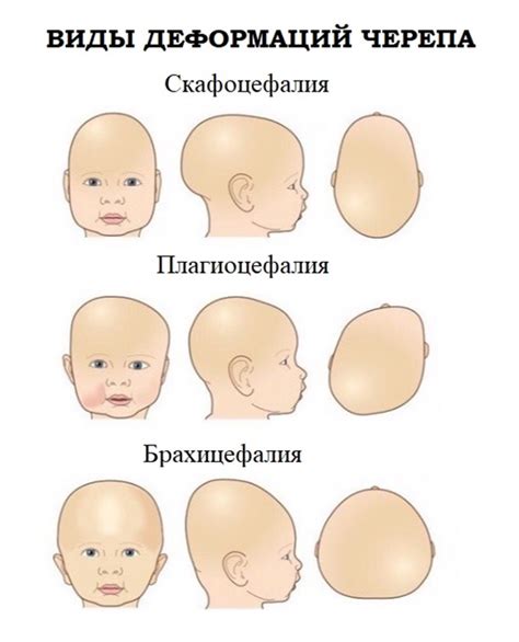 Головные травмы как причина изменения формы головы