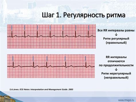 Диагностика нарушения проводимости