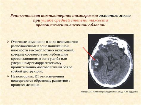 Диагностика черепно-мозговых травм