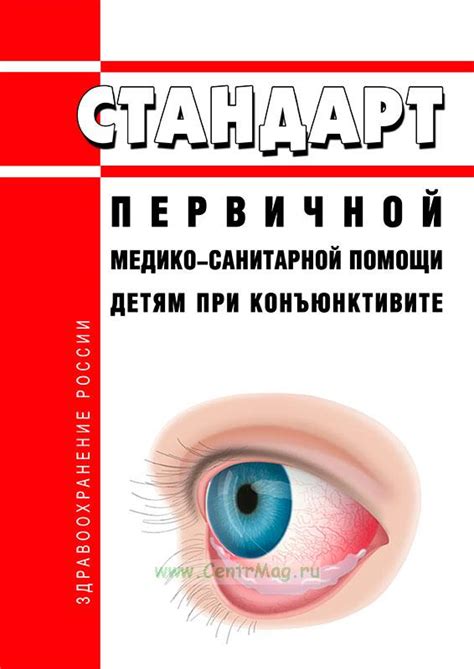 Другие специалисты, подходящие для помощи при конъюнктивите