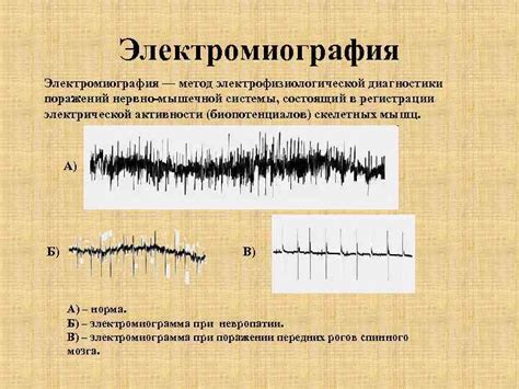 Измерение электрофизиологической активности тканей