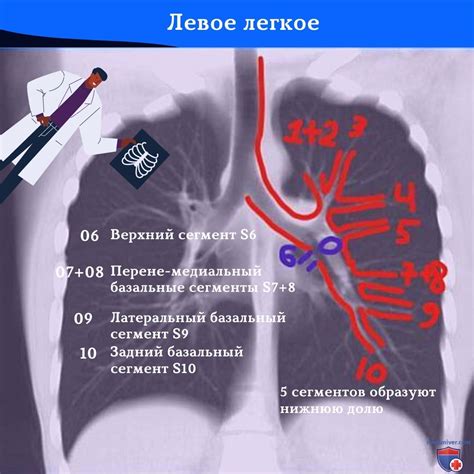 Изображение легких на рентгенограмме