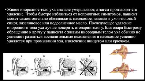 Импульсы и эмоции при промывании воспаленного слухового прохода