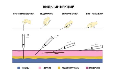 Какие препараты можно вводить через капельницу?