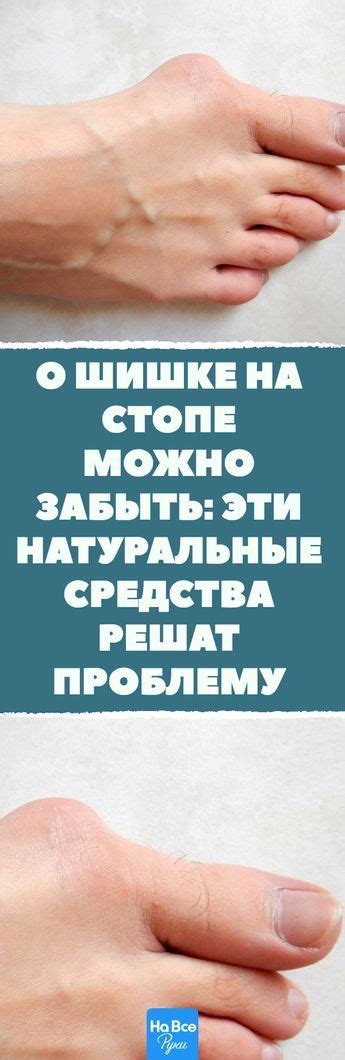 Как избавиться от нарыва на стопе: полезные методы и советы