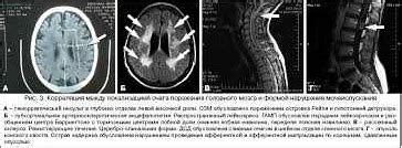 Как определить нарушение мочеиспускания?