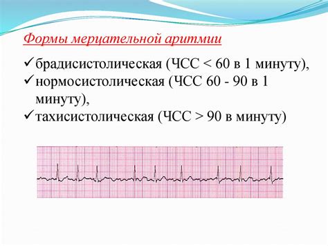 Клинические проявления нарушений проводимости