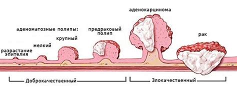 Когда опухоль кровоточит?