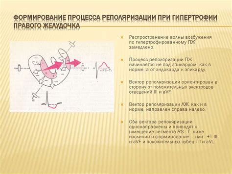 Лечение нарушения процесса реполяризации нижней стенки