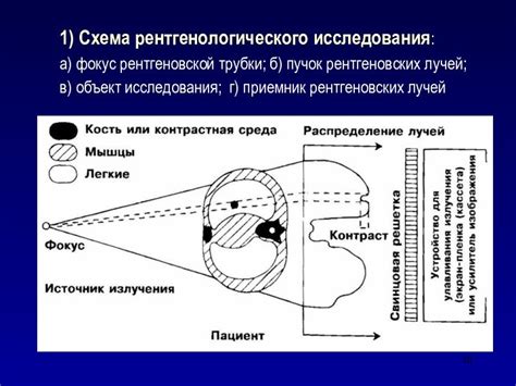 Лучевая диагностика с использованием рентгеновских лучей