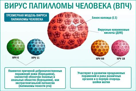 Медикаментозные способы борьбы с вирусом 66 типа ВПЧ: возможности лечения