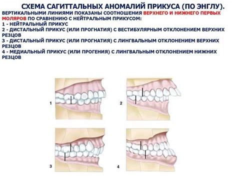 Методы диагностики и определения типа прикуса