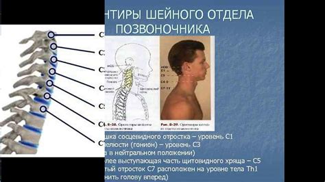 Методы диагностики онемения верхней конечности при поражении позвоночника в области шеи