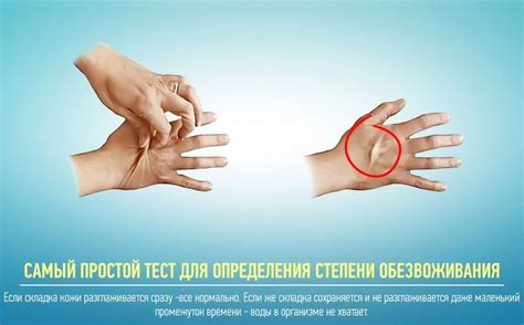 Методы предупреждения обезвоживания организма