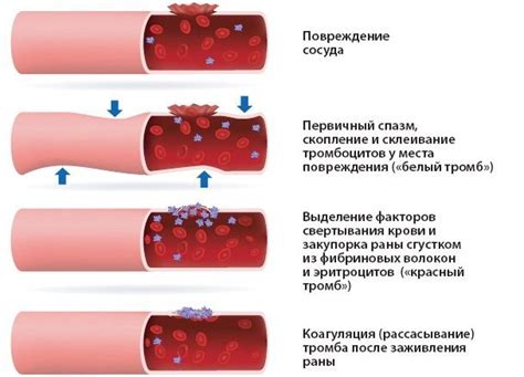 Нарушение системы свертывания крови