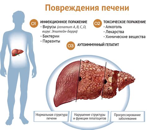 Нарушения в работе печени