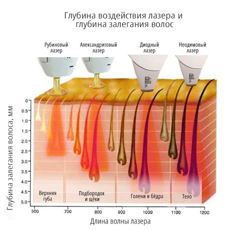 Насадки для эпиляции в воде