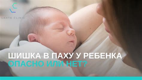 Не нашли шишку? Что делать?