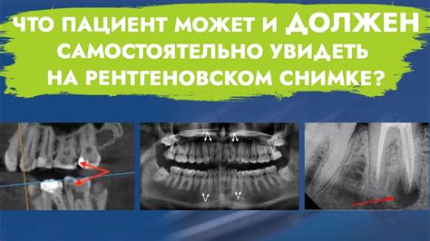 Обзор законодательства: шанс оплатить рентгеновское исследование без страхового полиса?