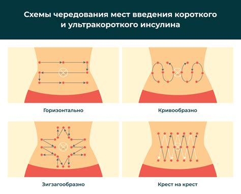 Обработка места инъекции