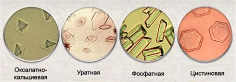 Оксалаты в клубнике: взаимосвязь с изменением оттенка мочи