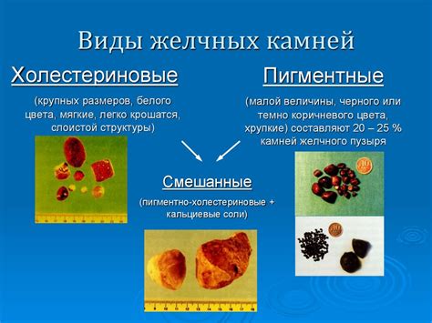 Опасности возникновения ущерба мочевым пузыре в процессе гистероскопии