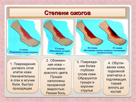 Определите степень травмы: