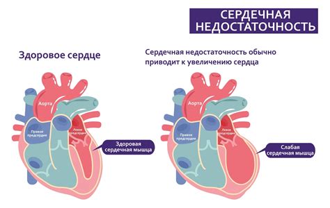 Основные признаки недостаточности работы сердца