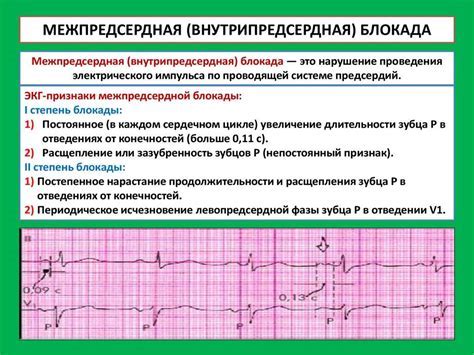 Основные симптомы нарушения внутрижелудочковой проходимости