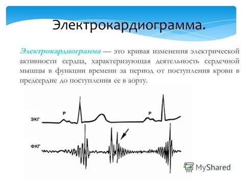 Особенности и значения изменений электрической активности мышц верхних полостей сердца на электрокардиограмме