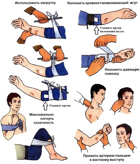 Остановка кровотечения: проверенные приемы и советы