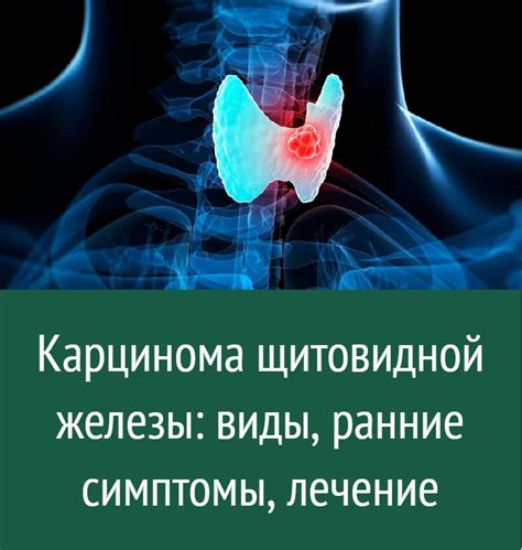 Патологии щитовидной железы: виды и симптомы