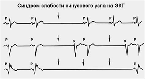 Плач - признак слабости?