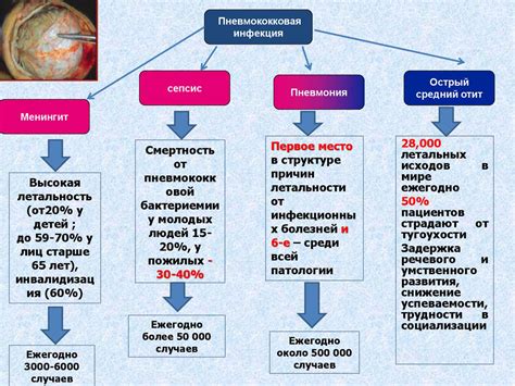 Пневмококковая инфекция может принести серьезные осложнения