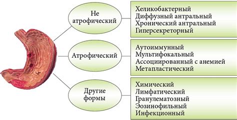 Повреждение желудка