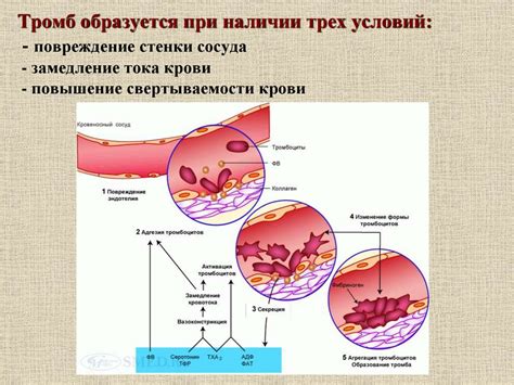 Повреждение сосуда: цвет крови при повреждении