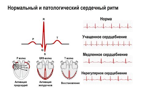 Повышенное сердцебиение после кофе: причины и возможные решения