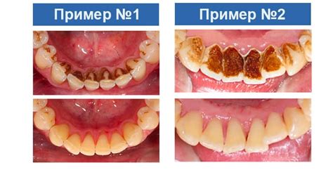 Подытоживание результатов чистки