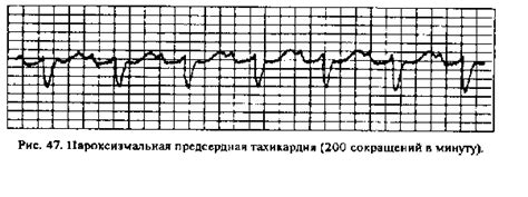 Помпезное повышение локализованной волны