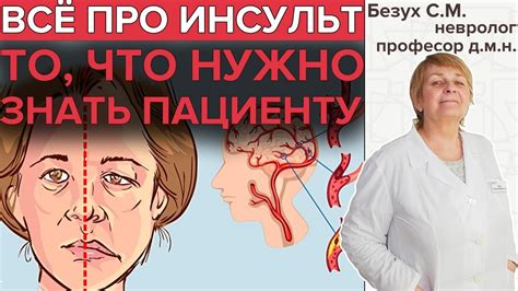 Популярный миф: инсульт при чихании